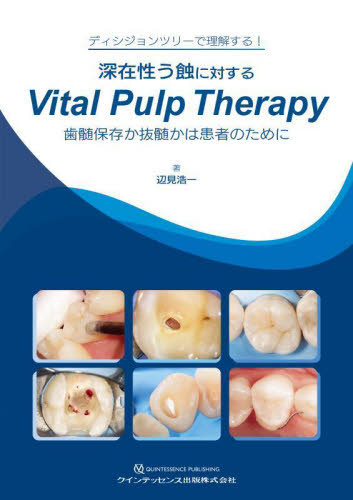深在性う蝕に対するVital Pulp Therapy 歯髄保存か抜髄かは患者のために ディシジョンツリーで理解する! 辺見浩一/著 臨床歯科学の本の商品画像