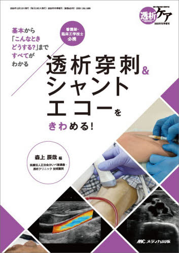 透析穿刺＆シャントエコーをきわめる！　基本から「こんなときどうする？」まですべてがわかる　看護師・臨床工学技士必携 森上辰哉／編 看護学の本その他の商品画像